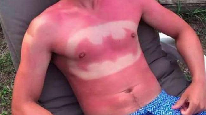 THE MOST EMBARRASSING AND WORST TAN LINES EVER