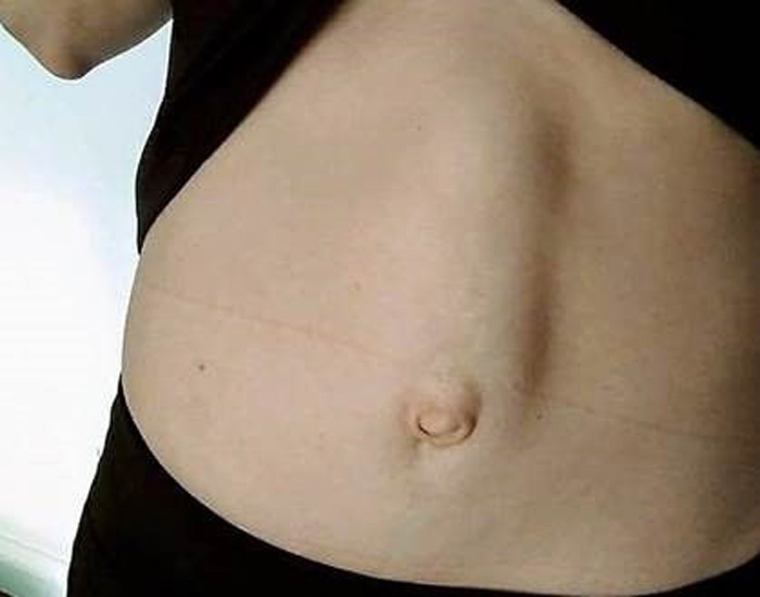 The Craziest Belly Buttons Ever