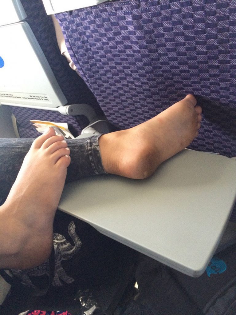 GROSS FEET ON AIRPLANES The Howler Monkey